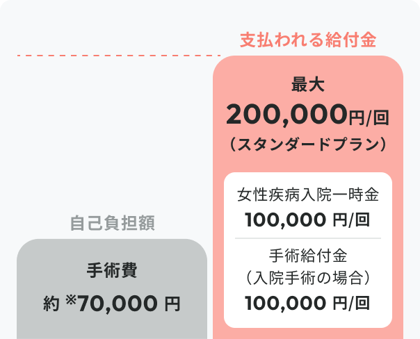 帝王切開：5人に1人が経験。自己負担額率70,000円に対し、スタンダードプランなら最化200,000円給付