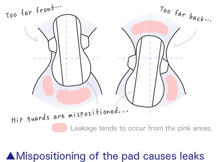 Mispositioning of the pad causes leaks