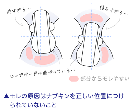 モレの原因はナプキンを正しい位置につけられていないこと