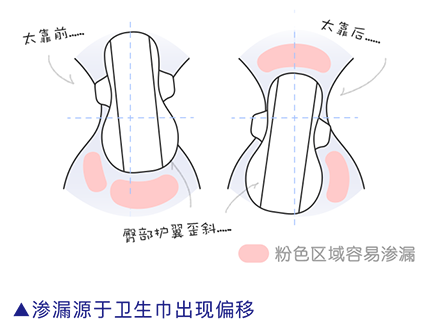 渗漏源于卫生巾出现偏移