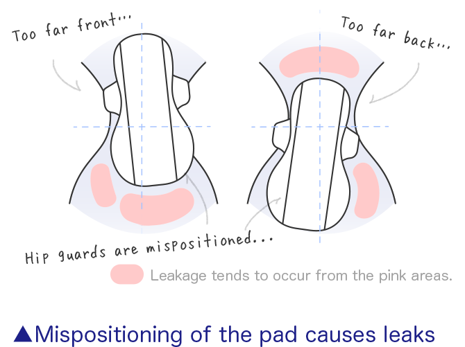 Mispositioning of the pad causes leaks