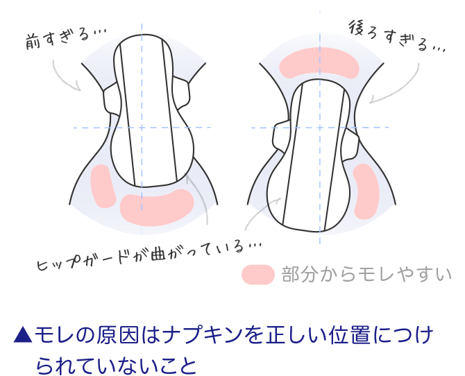 モレの原因はナプキンを正しい位置につけられていないこと