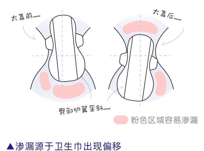 渗漏源于卫生巾出现偏移