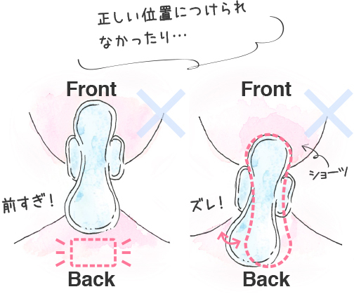 正しい位置につけられなかったり・・・