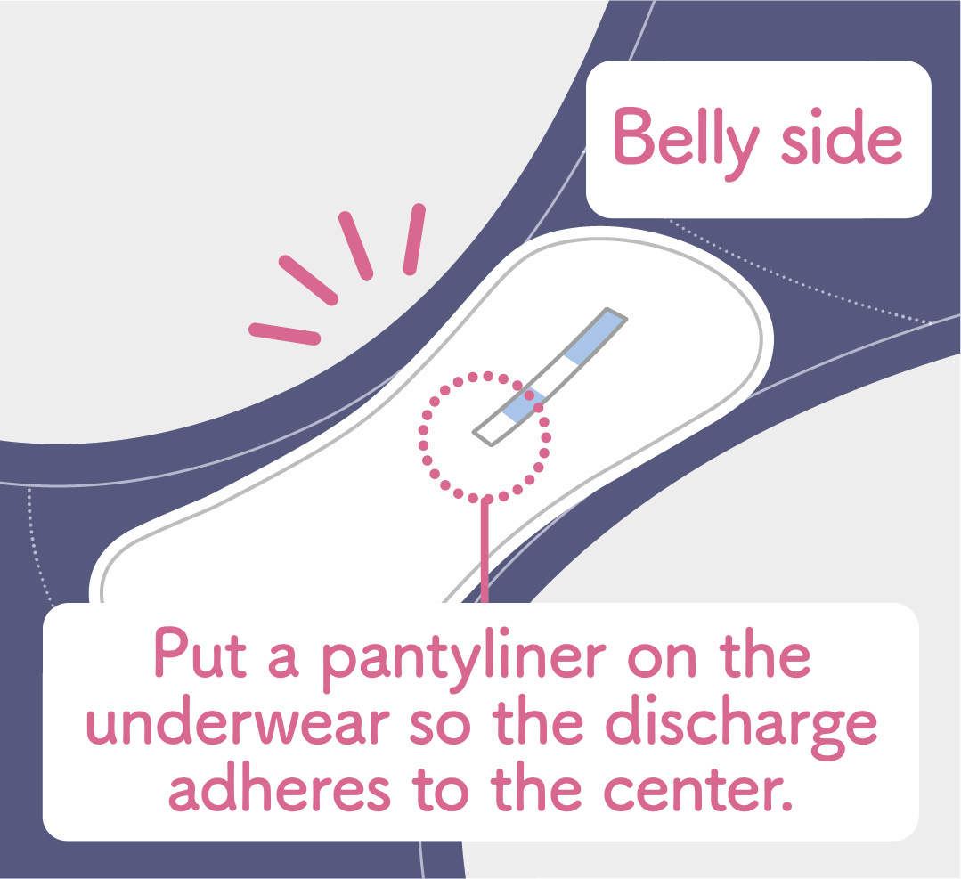 Put a pantyliner on the underwear so the discharge adheres to the center.