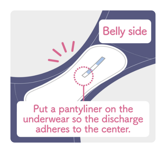Put a pantyliner on the underwear so the discharge adheres to the center.